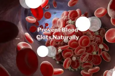 How to prevent blood clots naturally