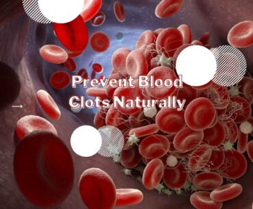 How to prevent blood clots naturally