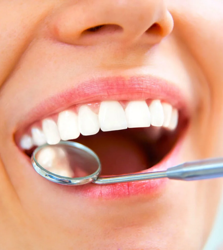 The Benefits And Harms Of Carbonated Beverages 4 Checking teeth